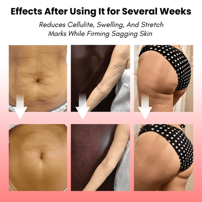 Alurisio® LED Lymphatic Drainage Body Sculpting Massager
