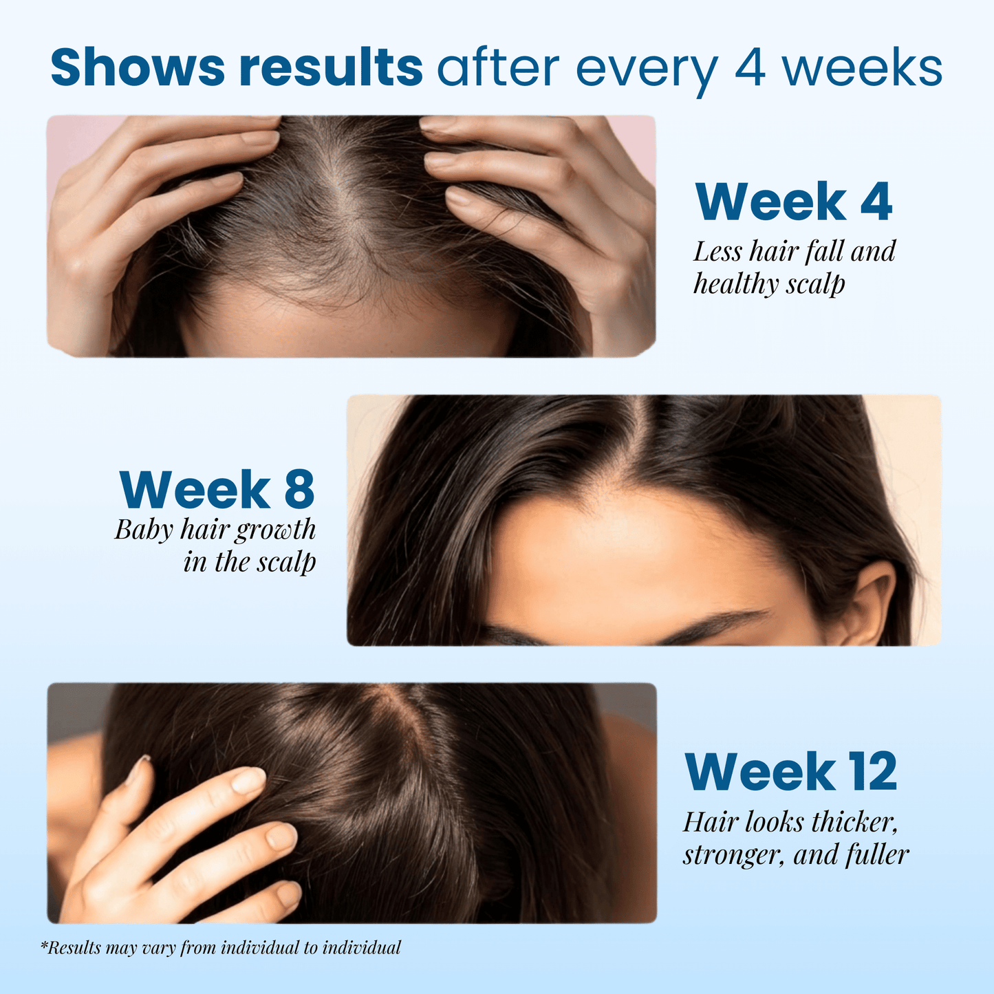 Alurisio® Advanced Hair Density Roll On Serum - 23% Hair Growth Actives