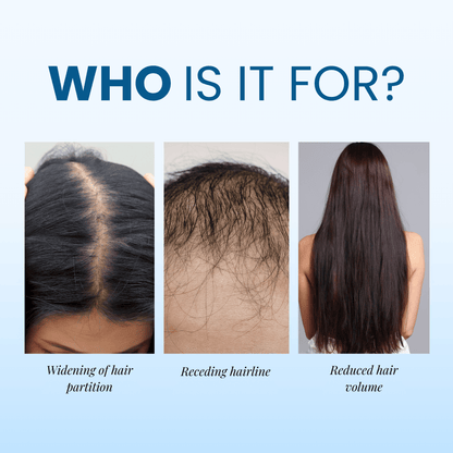 Alurisio® Advanced Hair Density Roll On Serum - 23% Hair Growth Actives