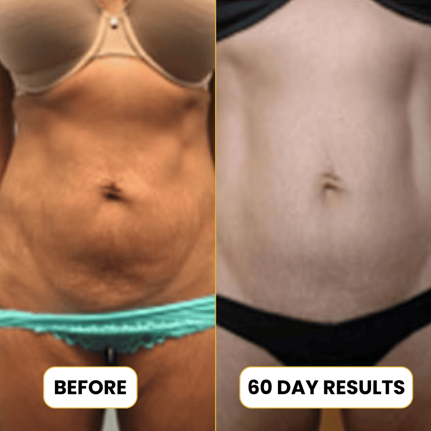 Anti-Cellulite Collagen + Stem Cell Oil