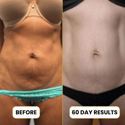 Anti-Cellulite Collagen + Stem Cell Oil