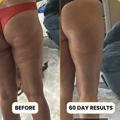Anti-Cellulite Collagen + Stem Cell Oil