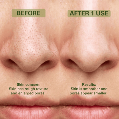 Holy Basil Bubble Deep Mask