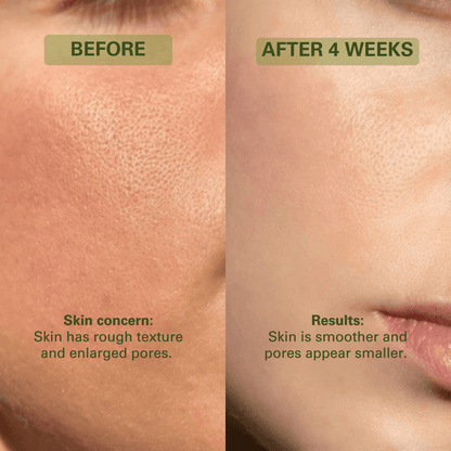 Holy Basil Bubble Deep Mask