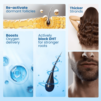 Alurisio® Advanced Hair Density Roll On Serum - 23% Hair Growth Actives